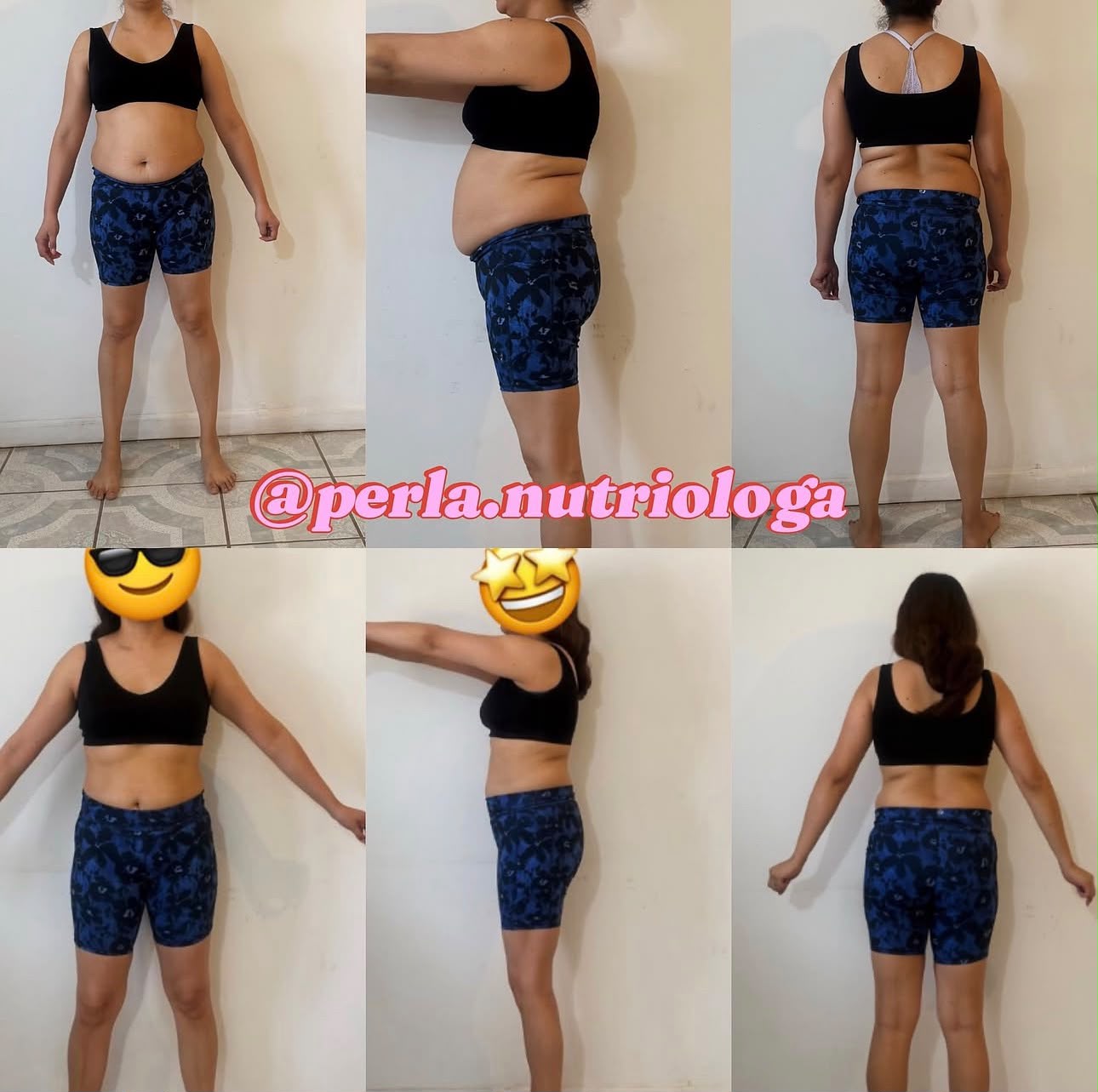 Resultado real de paciente 4